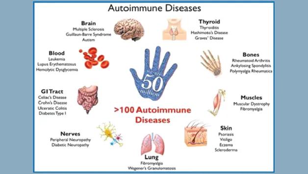 Autoimmune-1